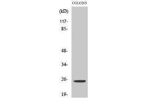 Western Blotting (WB) image for anti-Homeobox A7 (HOXA7) (Internal Region) antibody (ABIN3175532) (HOXA7 anticorps  (Internal Region))