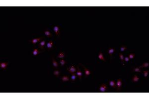 ABIN6266710 staining A549 cells by IF/ICC.