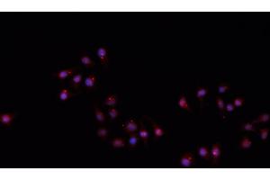 ABIN6266710 staining A549 cells by IF/ICC. (Hairless anticorps)