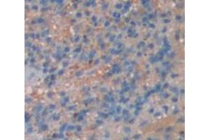 IHC-P analysis of Mouse Tissue, with DAB staining. (ITK anticorps  (AA 368-625))
