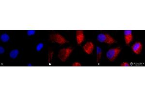 Immunocytochemistry/Immunofluorescence analysis using Rabbit Anti-TNF-R1 Polyclonal Antibody . (TNFRSF1A anticorps  (AA 20-43) (FITC))