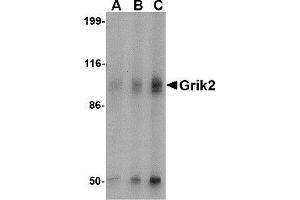 Western Blotting (WB) image for anti-Glutamate Receptor, Ionotropic, Kainate 2 (GRIK2) antibody (ABIN1030201) (GRIK2 anticorps)