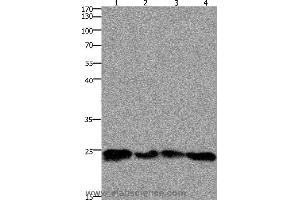 Western blot analysis of 293T and hela cell, mouse lung and brain tissue, using HMGB3 Polyclonal Antibody at dilution of 1:400 (HMGB3 anticorps)