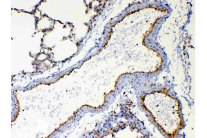 IHC analysis of TSPAN12 using anti-TSPAN12 antibody .