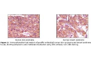 Image no. 1 for anti-Steroid Receptor RNA Activator 1 (SRA1) antibody (ABIN232101) (SRA1 anticorps)