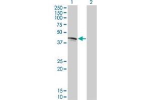 Western Blot analysis of FAS expression in transfected 293T cell line by FAS monoclonal antibody (M05), clone 2G3.