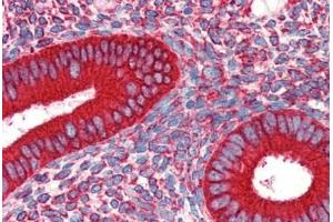 Human Uterus (formalin-fixed, paraffin-embedded) stained with HSP90B1 antibody ABIN462106 at 10 ug/ml followed by biotinylated secondary antibody, alkaline phosphatase-streptavidin and chromogen. (GRP94 anticorps)