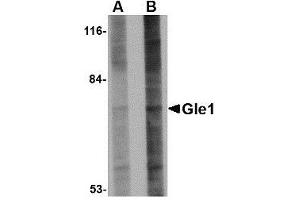 Western blot analysis of Gle1 in 293 cell lysate with AP30367PU-N Gle1 antibody at (A) 1 and (B) 2 μg/ml.