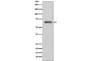 Western blot analysis of SGK1 expression in A431 cell lysate.