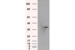 Western Blotting (WB) image for anti-Pleckstrin (PLEK) antibody (ABIN1500272) (Pleckstrin anticorps)