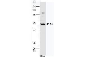 HeLa cell lysates probed with Rabbit Anti-ELP4 Polyclonal Antibody, Unconjugated (ABIN2559624) at 1:300 in 4˚C. (ELP4 anticorps  (AA 321-424))