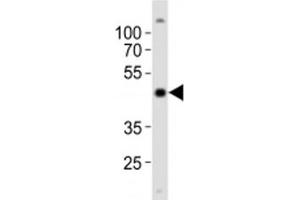 Western blot analysis of lysate from NCCIT cell line using POU5F1 antibody at 1:1000.