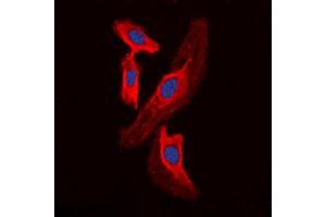 anti-Fragile Histidine Triad (FHIT) (Center) antibody