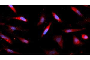 Immunofluorescence (IF) image for anti-AlkB, Alkylation Repair Homolog 3 (ALKBH3) (AA 1-286) antibody (APC) (ABIN5565112) (ALKBH3 anticorps  (AA 1-286) (APC))