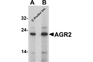 Western Blotting (WB) image for anti-Anterior Gradient Homolog 2 (Xenopus Laevis) (AGR2) (N-Term) antibody (ABIN1077447) (AGR2 anticorps  (N-Term))
