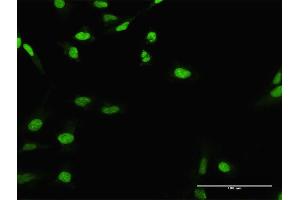 Immunofluorescence of purified MaxPab antibody to CIRBP on HeLa cell. (CIRBP anticorps  (AA 1-172))
