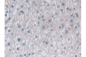 Detection of PSMb6 in Human Liver Tissue using Polyclonal Antibody to Proteasome Subunit Beta Type 6 (PSMb6)