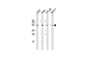All lanes : Anti-p53 Antibody  at 1:2000 dilution Lane 1: A431 whole cell lysate Lane 2: Hela whole cell lysate Lane 3: HT-29 whole cell lysate Lane 4: MCF-7 whole cell lysate Lysates/proteins at 20 μg per lane.
