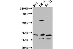 Western Blot Positive WB detected in: 293 whole cell lysate, THP-1 whole cell lysate, HepG2 whole cell lysate All lanes: COMT Antibody at 1:1000 Secondary Goat polyclonal to rabbit IgG at 1/50000 dilution Predicted band size: 31, 25 kDa Observed band size: 31 kDa (Recombinant COMT anticorps)