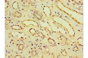 Immunohistochemistry of paraffin-embedded human kidney tissue using ABIN7146201 at dilution of 1:100