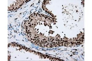 Immunohistochemical staining of paraffin-embedded liver tissue using anti-ERCC1 mouse monoclonal antibody. (ERCC1 anticorps)