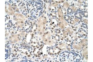 PSAT1 antibody was used for immunohistochemistry at a concentration of 4-8 ug/ml to stain Epithelial cells of renal tubule (arrows) in Human Kidney. (PSAT1 anticorps  (N-Term))