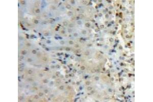 Used in DAB staining on fromalin fixed paraffin-embedded Kidney tissue (SUV420H2/KMT5C anticorps  (AA 2-279))