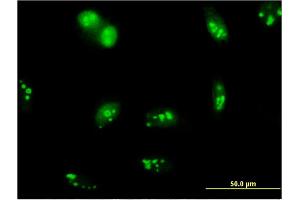 Immunofluorescence of monoclonal antibody to SENP5 on HeLa cell.