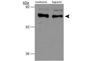 Western blot analysis of human PHD4 using P4HTM polyclonal antibody .