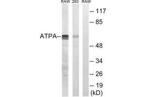 Western Blotting (WB) image for anti-ATP Synthase, H+ Transporting, Mitochondrial F1 Complex, alpha Subunit 1, Cardiac Muscle (ATP5A1) (Internal Region) antibody (ABIN1850831) (ATP5A1 anticorps  (Internal Region))