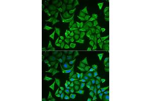 Immunofluorescence analysis of A549 cells using DTYMK antibody. (DTYMK anticorps  (AA 1-212))