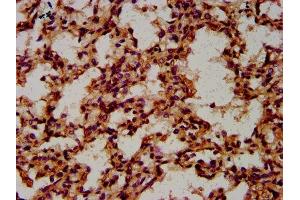 IHC image of ABIN7148531 diluted at 1:600 and staining in paraffin-embedded human lung tissue performed on a Leica BondTM system.
