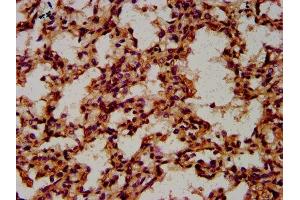 IHC image of ABIN7148531 diluted at 1:600 and staining in paraffin-embedded human lung tissue performed on a Leica BondTM system. (CPNE8 anticorps  (AA 349-498))