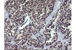 Image no. 6 for anti-RAB37, Member RAS Oncogene Family (RAB37) antibody (ABIN1500561)