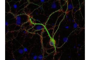 Indirect immunostaining of PFA fixed rat hippocampus neurons with anti-amphiphysin (dilution 1 : 500; red) and mouse anti-MAP 2 (, dilution 1 : 500; green).