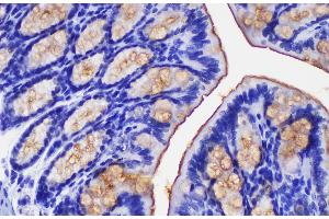 Immunohistochemistry of paraffin-embedded Mouse colon using Ceacam1 Polycloanl Antibody at dilution of 1:200 (CEACAM1 anticorps)