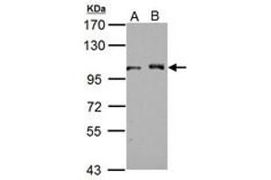 Image no. 2 for anti-DEAD (Asp-Glu-Ala-Asp) Box Polypeptide 23 (DDX23) (AA 136-350) antibody (ABIN1501884)