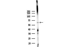 anti-Phospholipase A2, Group III (PLA2G3) antibody