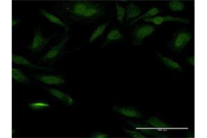Immunofluorescence of purified MaxPab antibody to PEX14 on HeLa cell.