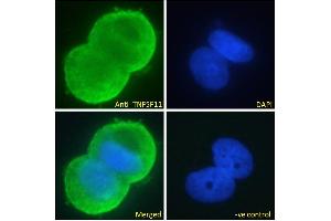 ABIN6391341 Immunofluorescence analysis of paraformaldehyde fixed MCF7 cells, permeabilized with 0. (RANKL anticorps  (Internal Region))