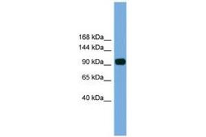 Image no. 1 for anti-Poly (ADP-Ribose) Polymerase Family, Member 8 (PARP8) (AA 21-70) antibody (ABIN6746207) (PARP8 anticorps  (AA 21-70))