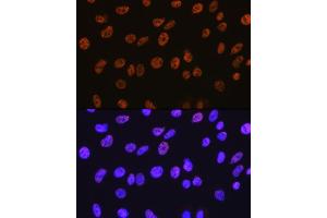 Immunofluorescence analysis of C6 cells using HD antibody (ABIN7267707) at dilution of 1:100.