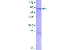 Image no. 1 for RUN and SH3 Domain Containing 1 (RUSC1) (AA 1-433) protein (GST tag) (ABIN1319004)