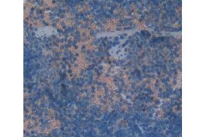 Used in DAB staining on fromalin fixed paraffin- embedded Kidney tissue (KLRK1 anticorps  (AA 90-232))