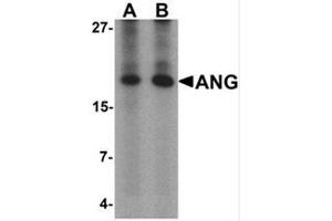 Western blot analysis of ANG in rat liver tissue lysate with Ang Antibody  at (A) 1 and (B) 2 μg/mL. (ANG anticorps  (Middle Region))