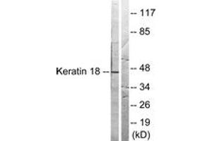 Western blot analysis of extracts from HeLa cells, treated with UV 5', using Keratin 18 (Ab-33) Antibody. (Cytokeratin 18 anticorps  (AA 1-50))