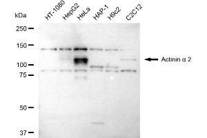 Western blotting analysis using Actinin alpha 2 antibody (ABIN7797472).