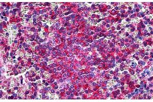 anti-Lymphocyte Cytosolic Protein 1 (LCP1) (Headpiece Region) antibody