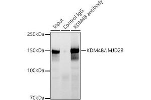 Immunoprecipitation analysis of 300 μg extracts of HCT116 cells using 3 μg KDM4B/JMJD2B antibody (ABIN7268329). (KDM4B anticorps)