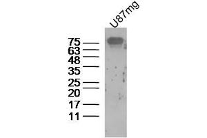 Human U87mg cells probed with beta amyloid 1-16 Polyclonal Antibody, unconjugated  at 1:300 overnight at 4°C followed by a conjugated secondary antibody at 1:10000 for 90 minutes at 37°C. (beta Amyloid 1-16 (AA 1-16) anticorps)
